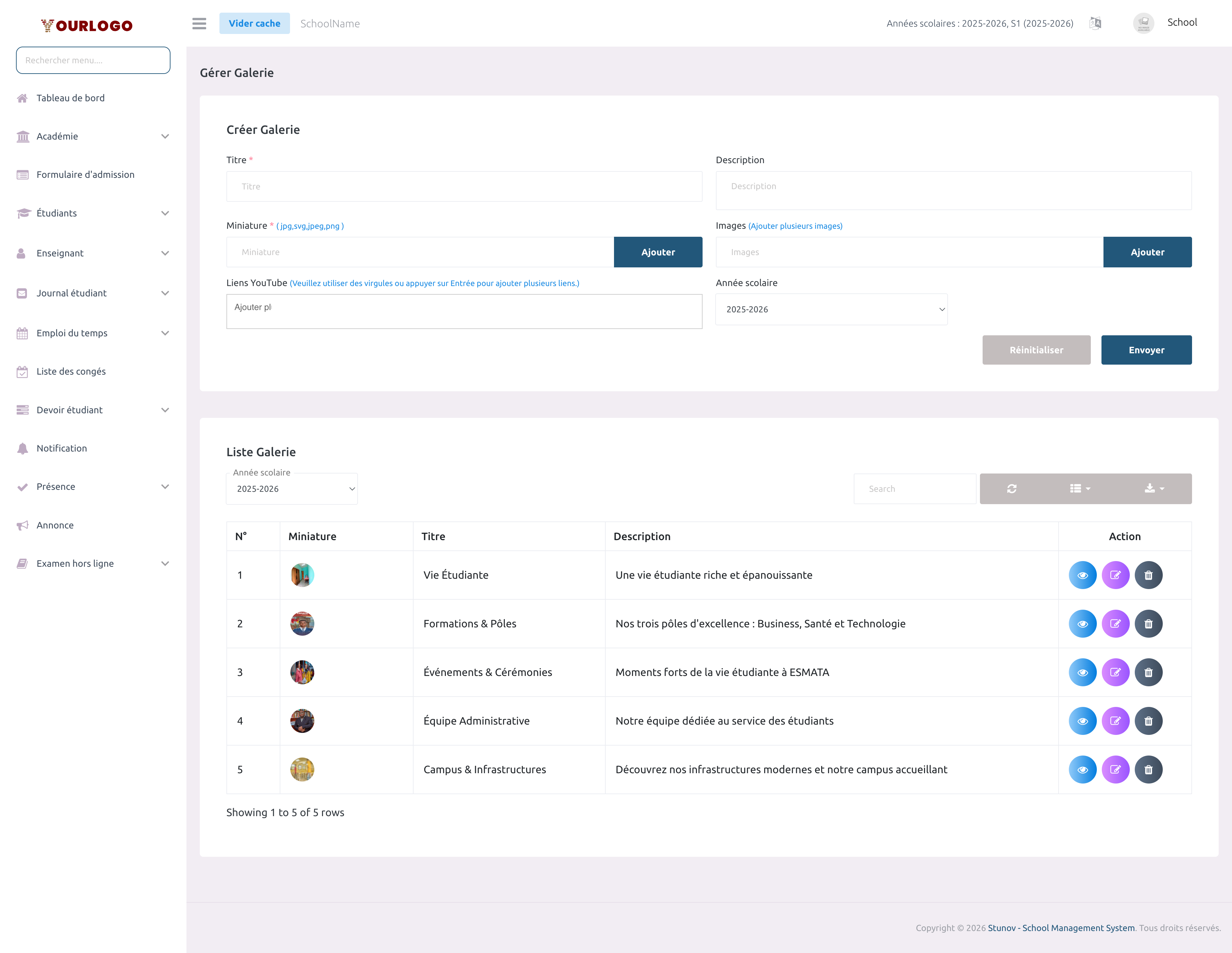 Page de gestion de la galerie affichant un tableau d'albums existants avec miniature, titre, année scolaire et boutons d'action